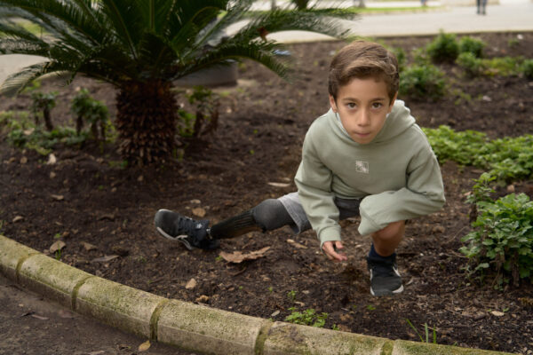 Prótesis_Miembro Inferior_Tibial_Fernando_978 0159 Prótesis_Miembro Inferior_Tibial_Fernando_978 0159