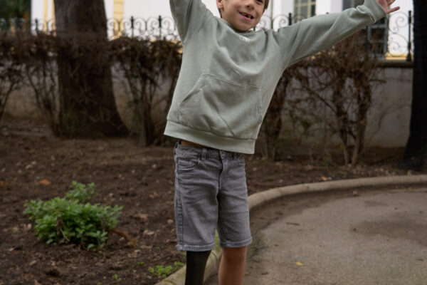 Prótesis_Miembro Inferior_Tibial_Fernando_978 0183 Prótesis_Miembro Inferior_Tibial_Fernando_978 0183