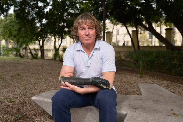 Prótesis_Miembro Superior_Biónica_Ginés_978 0406