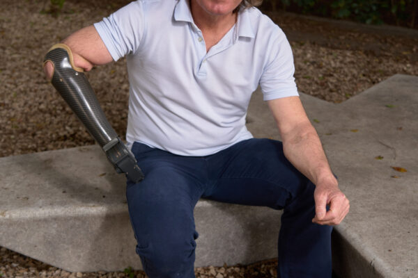 Prótesis_Miembro Superior_Biónica_Ginés_978 0411