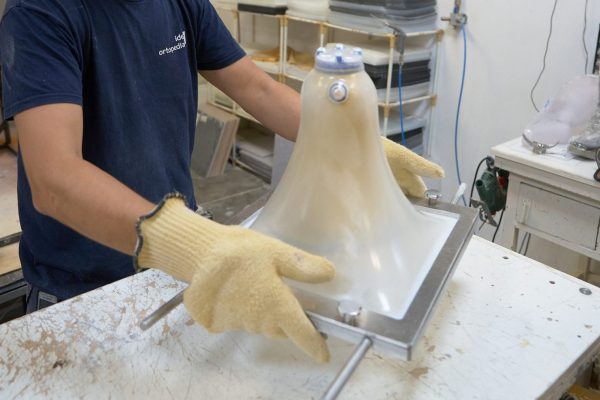 Adaptación prótesis en termoplástico_5